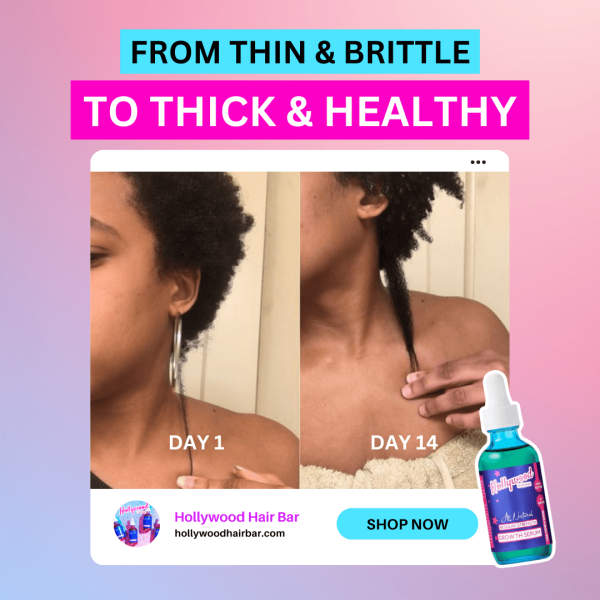 Regular Hair Growth Serum Hot on Sale - Image 3